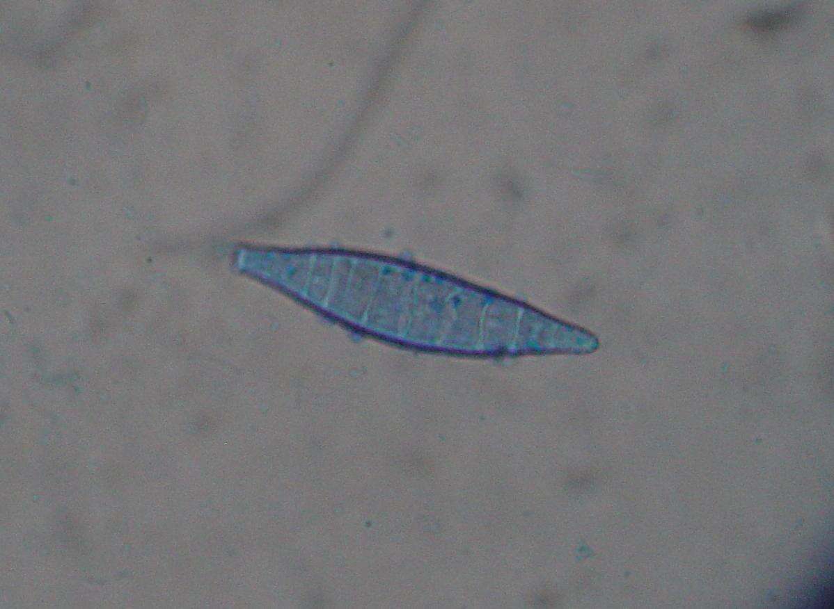 Sivun Microsporum canis E. Bodin ex Guég. 1902 kuva