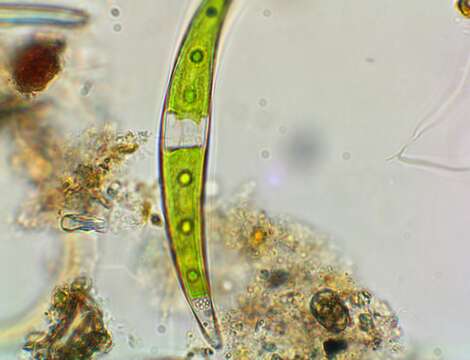 Closterium dianae Ehrenberg ex Ralfs 1848 resmi