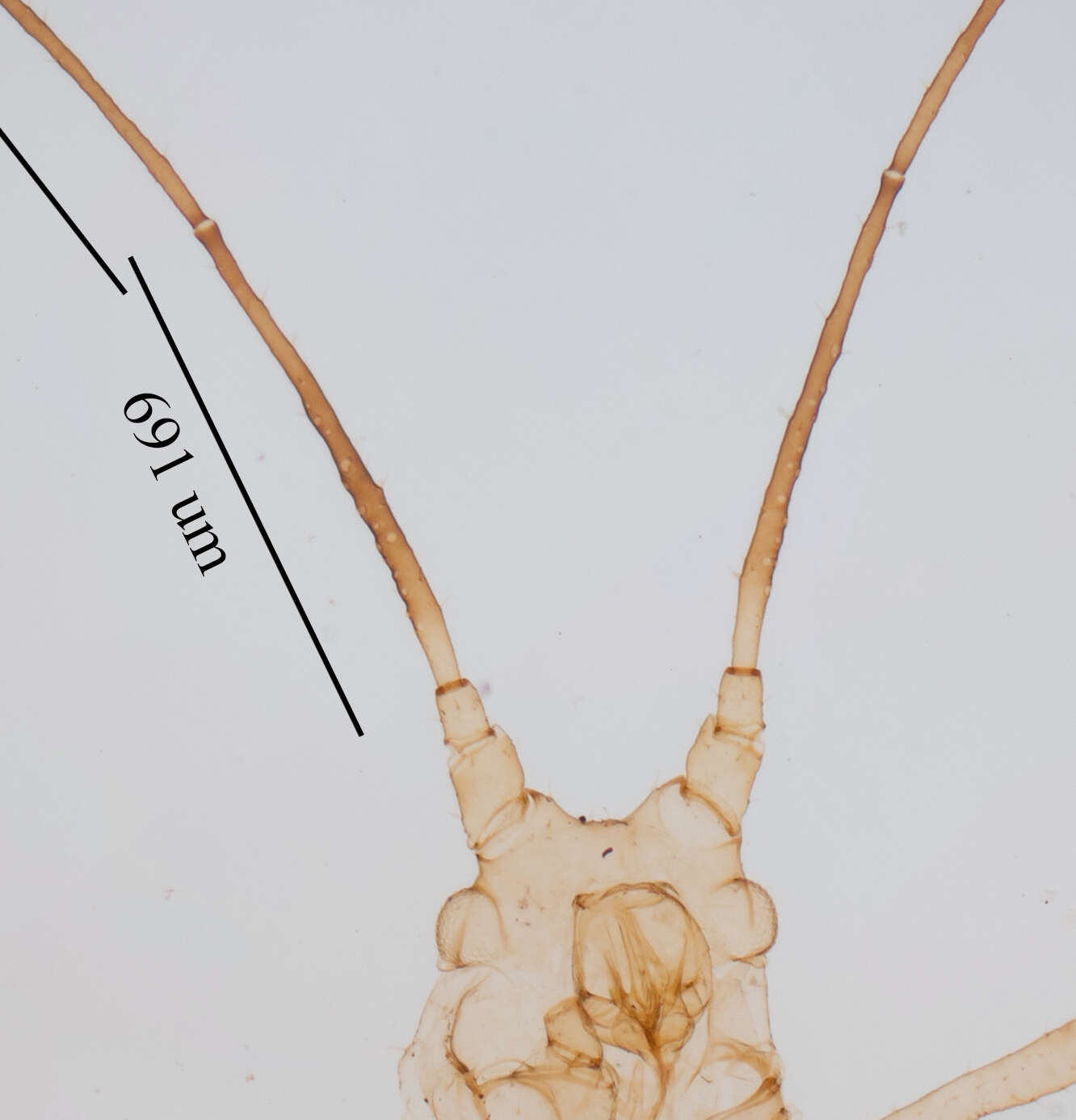 صورة Uroleucon (Lambersius) erigeronense (Thomas & C. 1878)