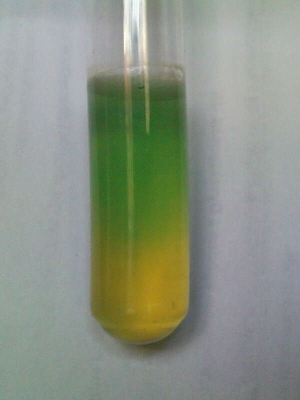 Слика од Pseudomonas aeruginosa