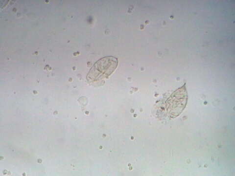 Image of Schistosoma haematobium
