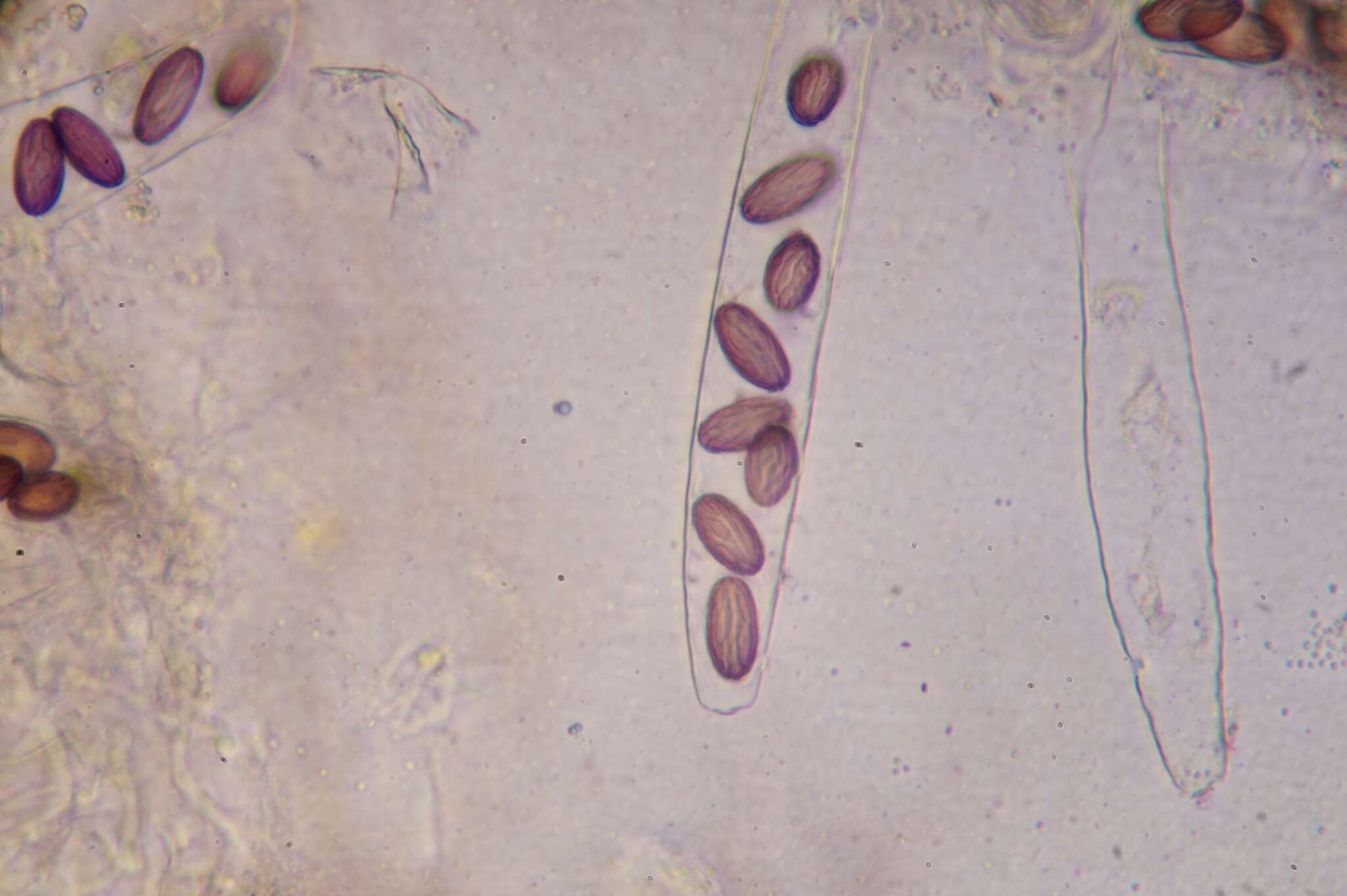 Image de Ascobolus sacchariferus Brumm. 1967