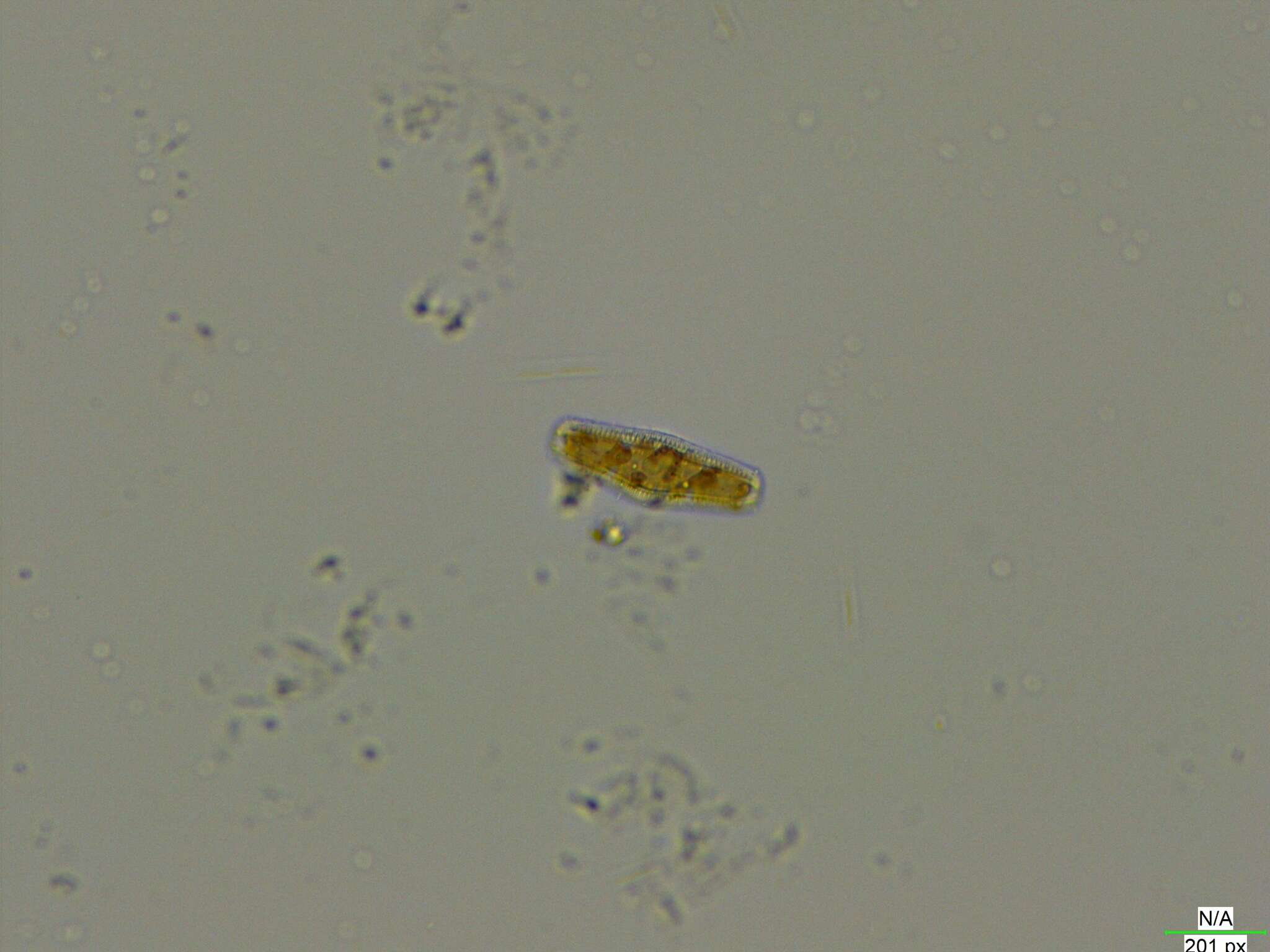 Image of <i>Epithemia gibba</i> Kützing