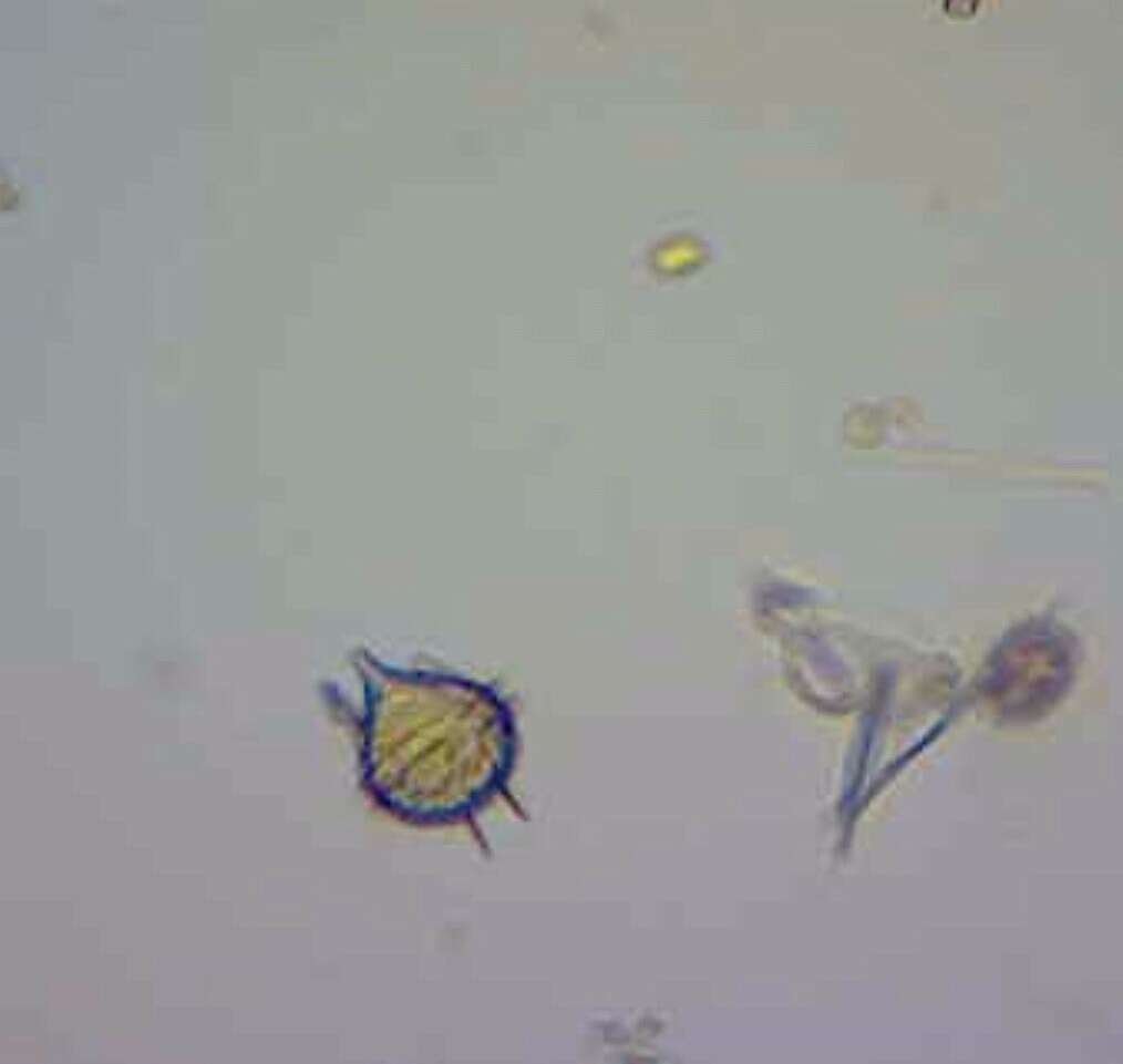 Image of Protoperidinium steinii (Jorgensen) Balech 1974