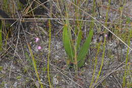 Image of White fingers