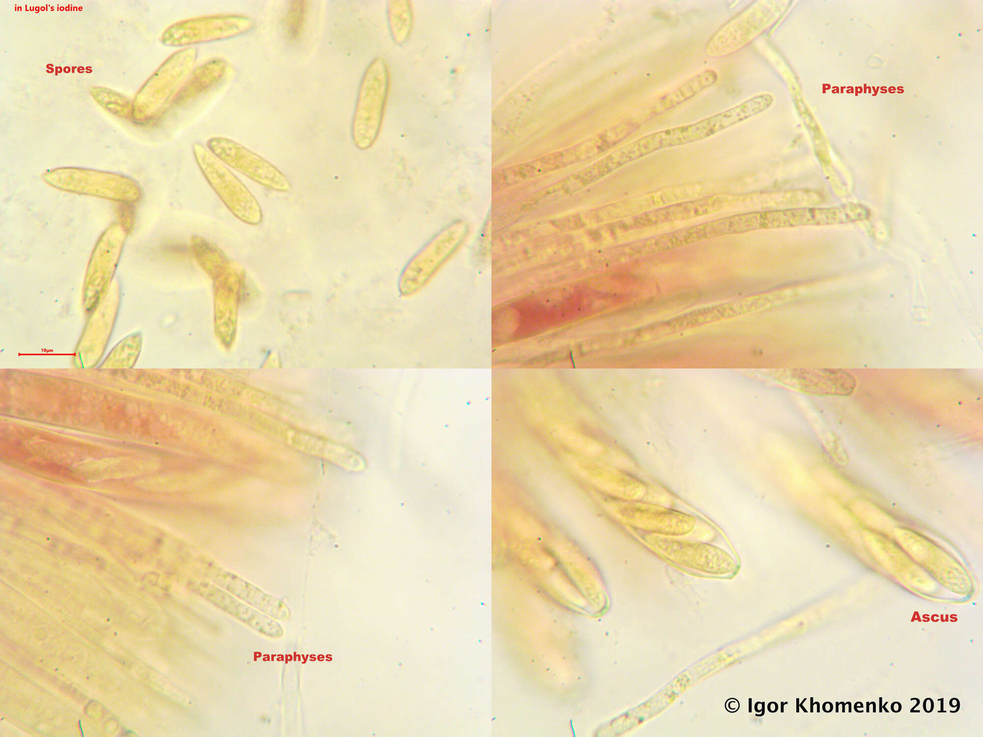 Image of Hymenoscyphus caudatus (P. Karst.) Dennis 1964