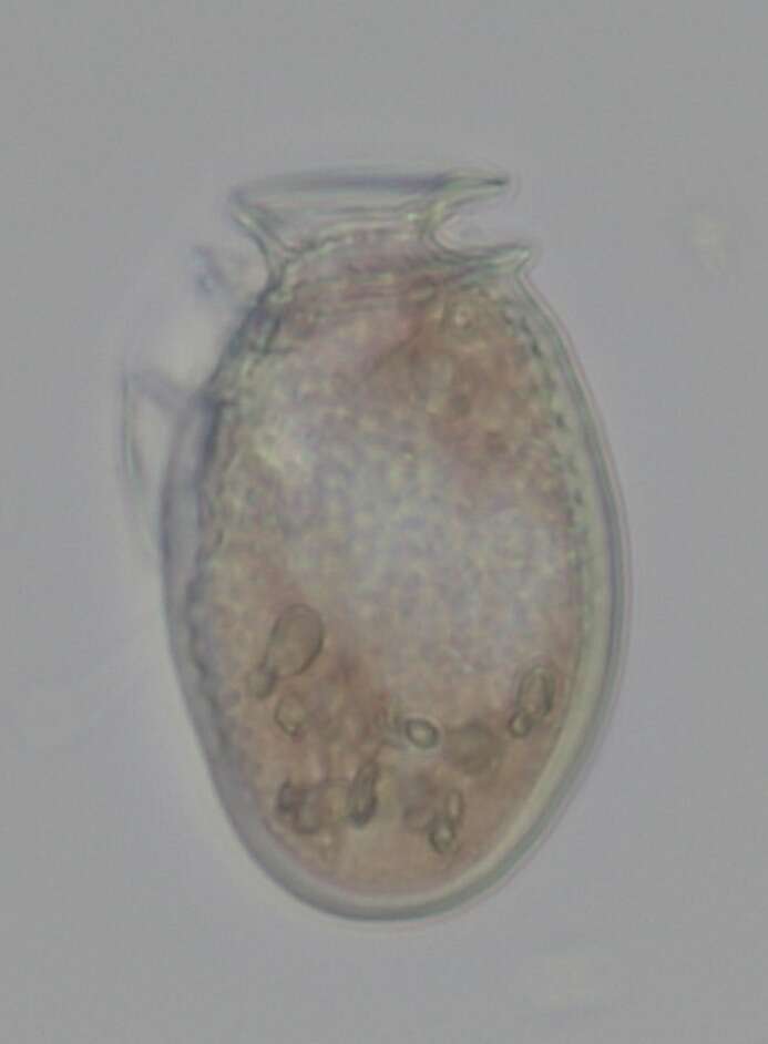 Dinophysis acuminata resmi