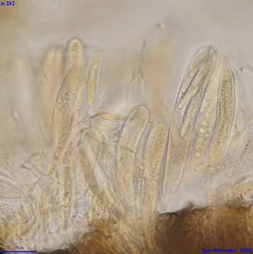 Image of Durella connivens (Fr.) Rehm 1881