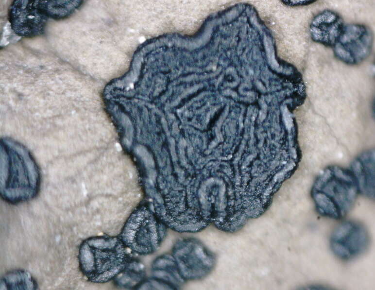 Image of navel lichen