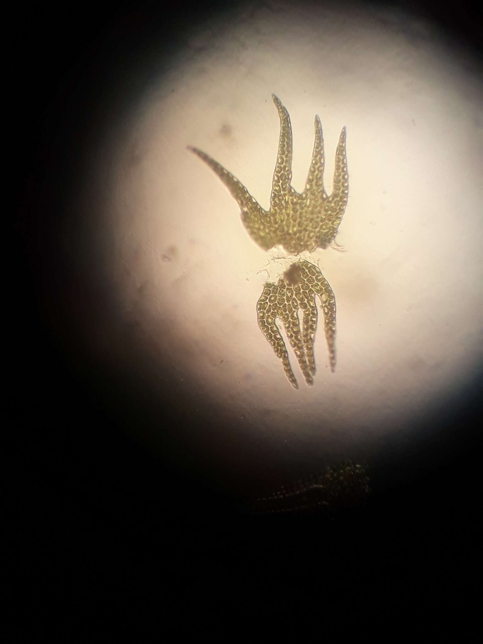 Image of Lepidozia spinosissima (Hook. fil. & Taylor) Mitt.