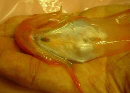 Image of Meder’s snailfish