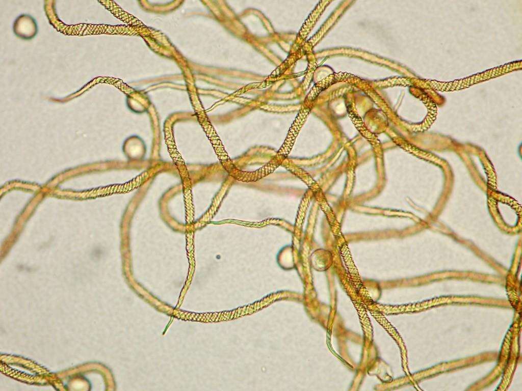 Image of Trichia ambigua Schirmer, L. G. Krieglst. & Flatau 2015