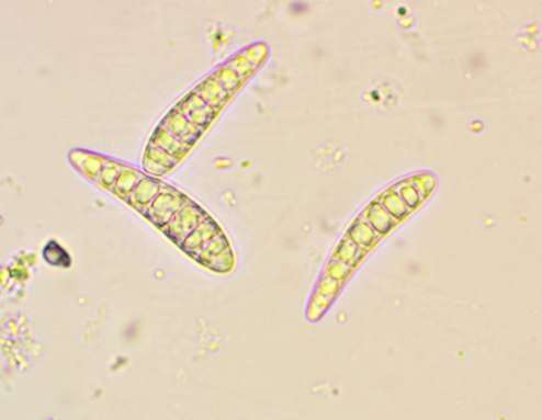 Image of Patellaria