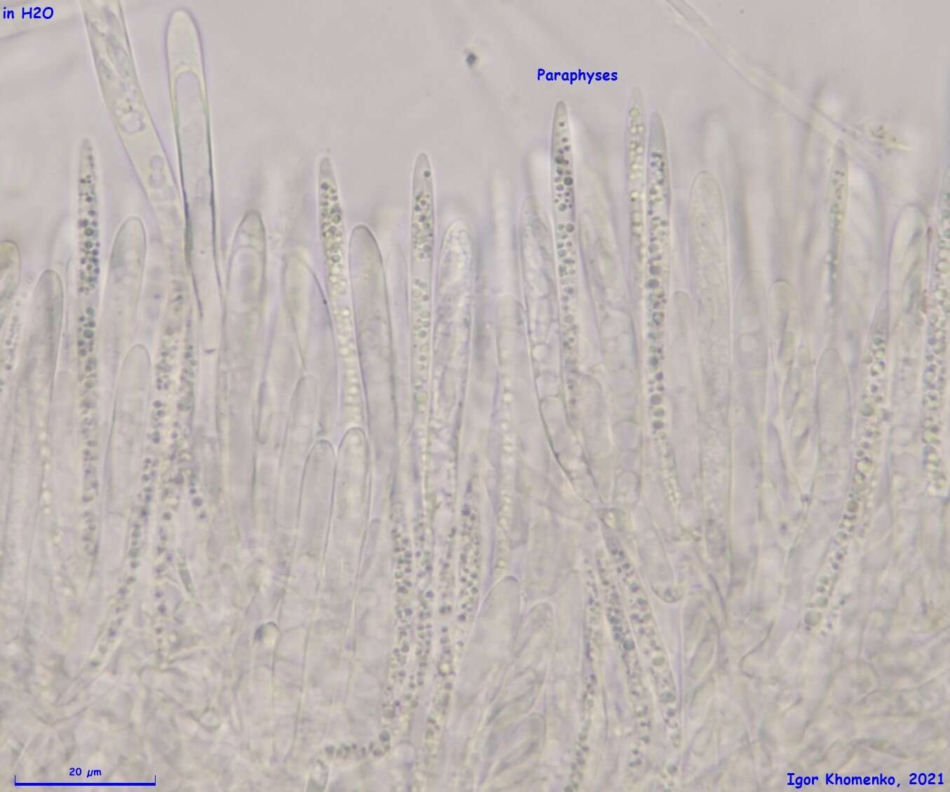 Image of Lachnum brevipilosum Baral 1985