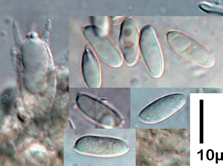 Image of Echinochaete russiceps (Berk. & Broome) D. A. Reid 1963