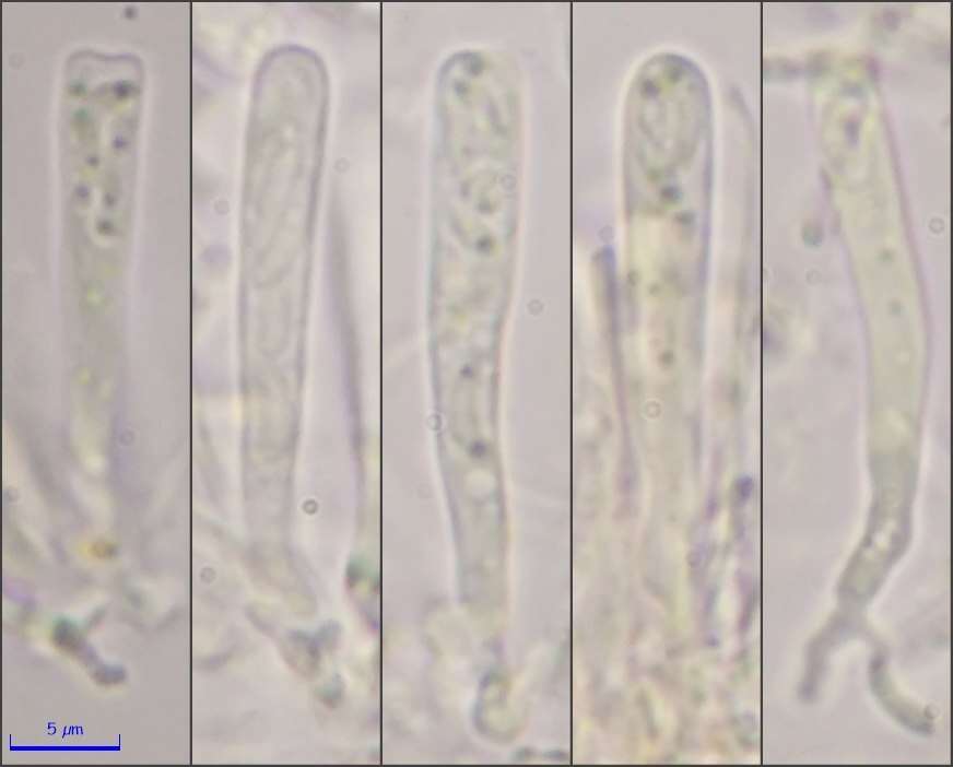 Image of Orbilia xanthoflexa