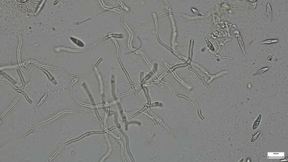 Image de Sirobasidium magnum Boedijn 1934