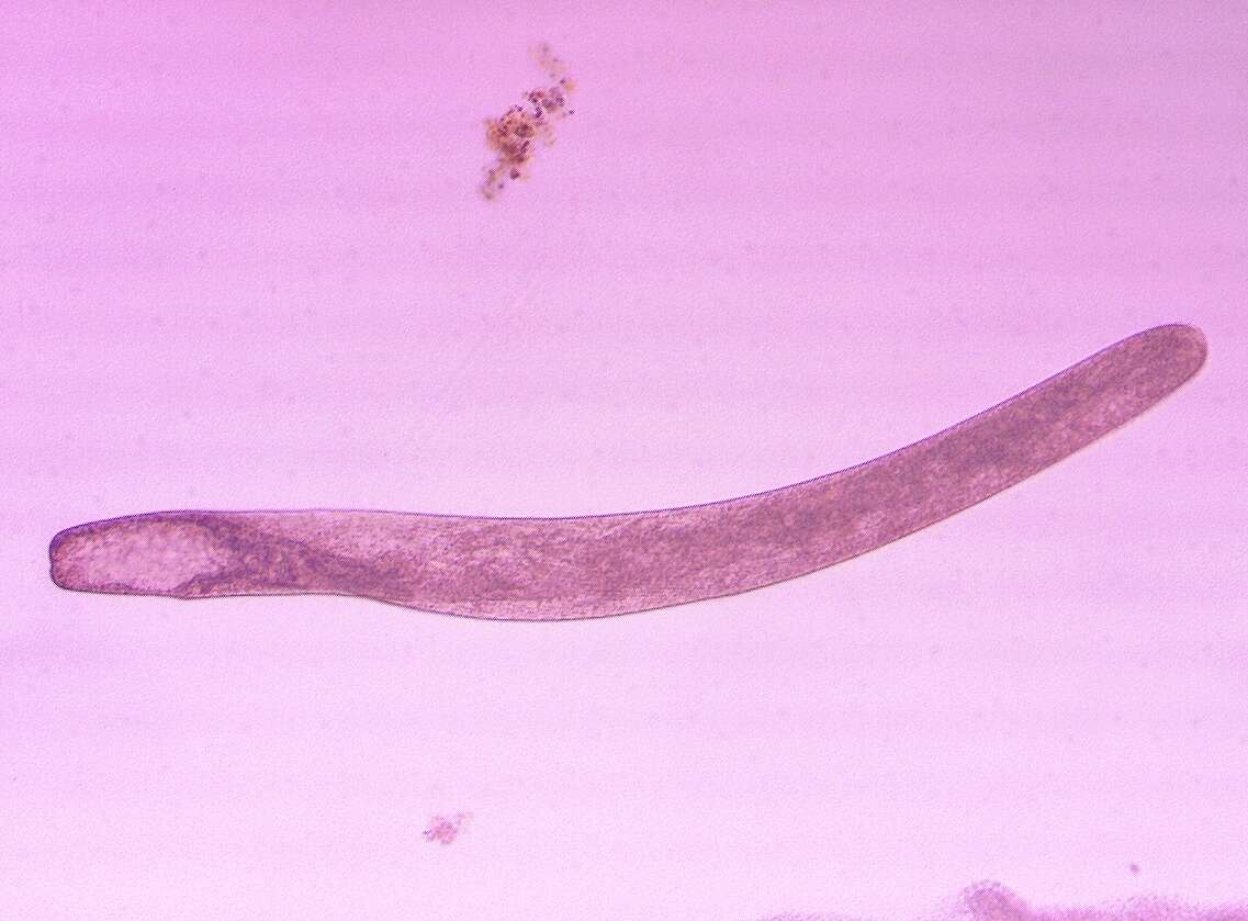 Image of Spirostomum ambiguum