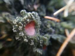 Image of skin lichen