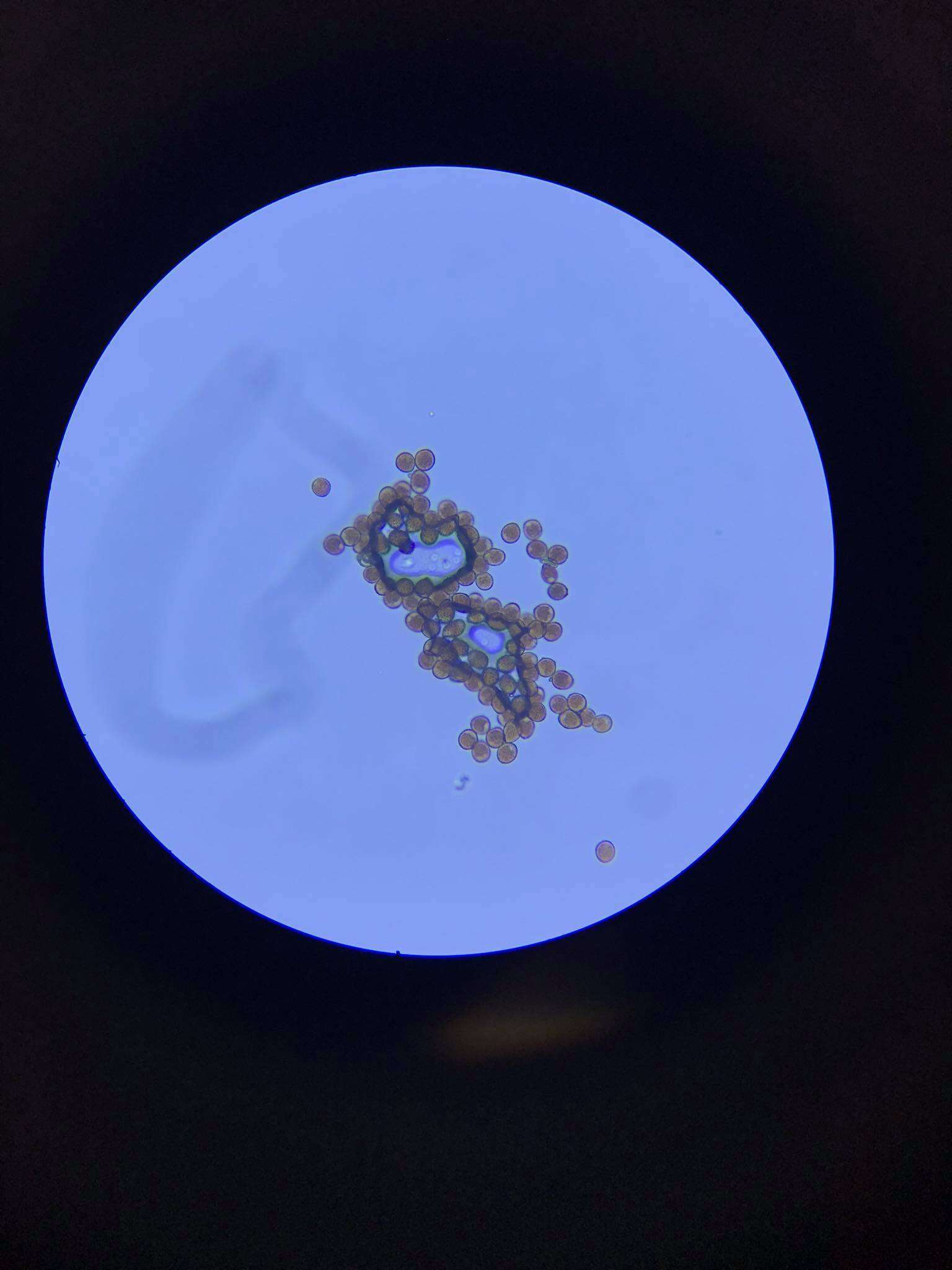 Image of Uromyces beticola (Bellynck) Boerema, Loer. & Hamers 1987