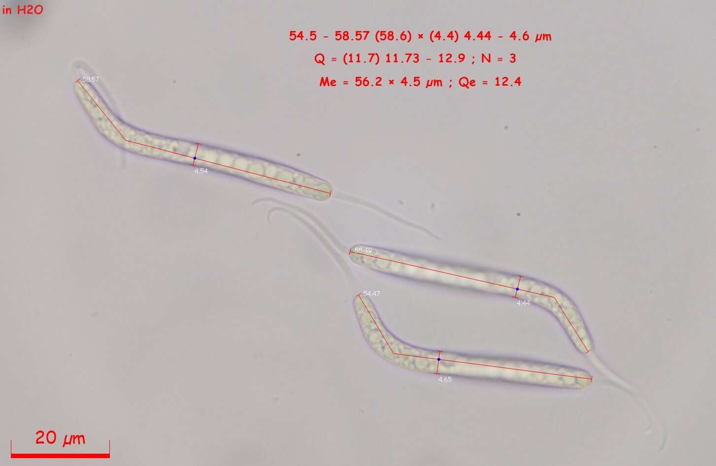 Image of Cercophora scortea (Cain) N. Lundq. 1972