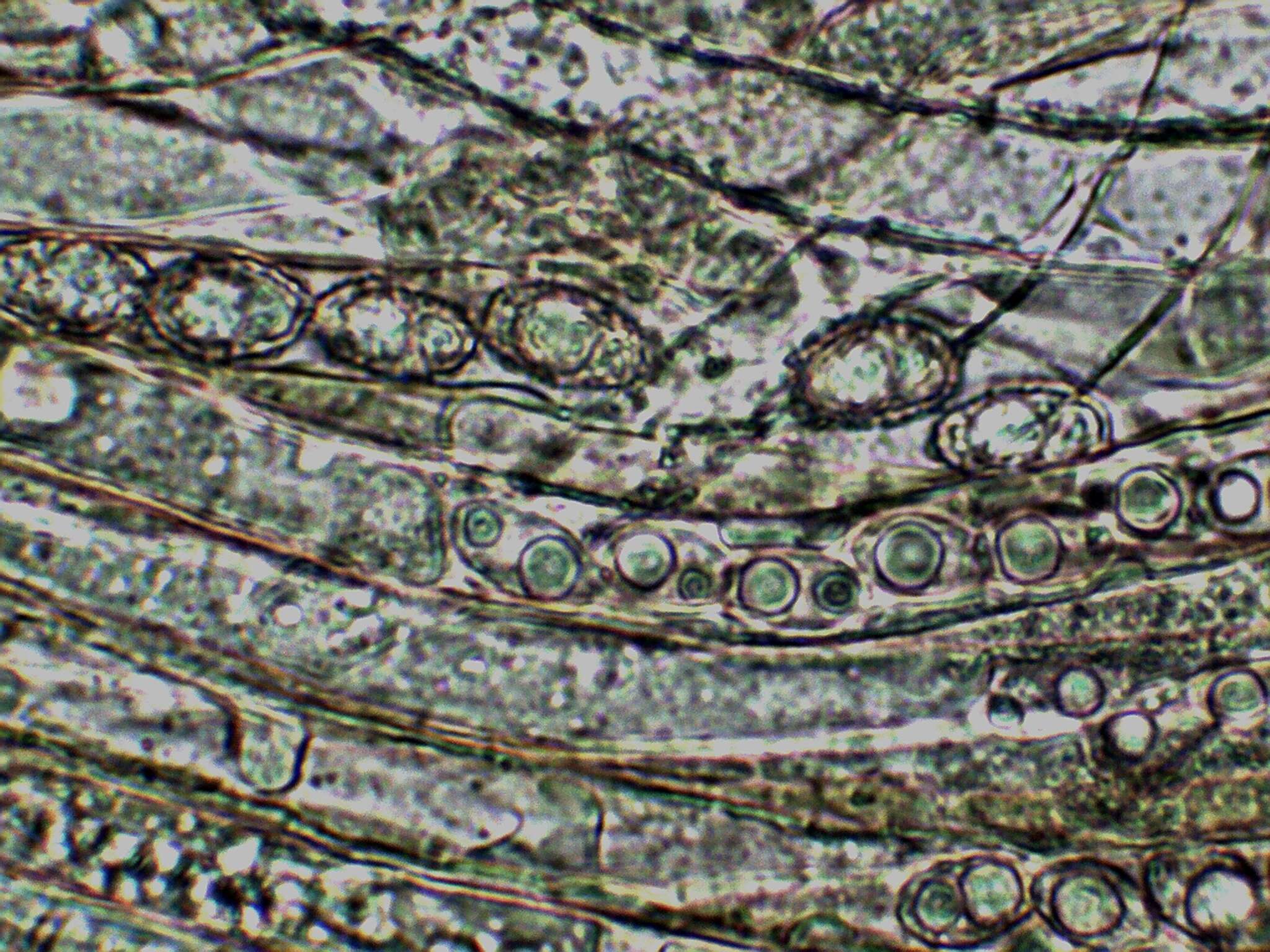 Imagem de Pachyella celtica (Boud.) Häffner 1993