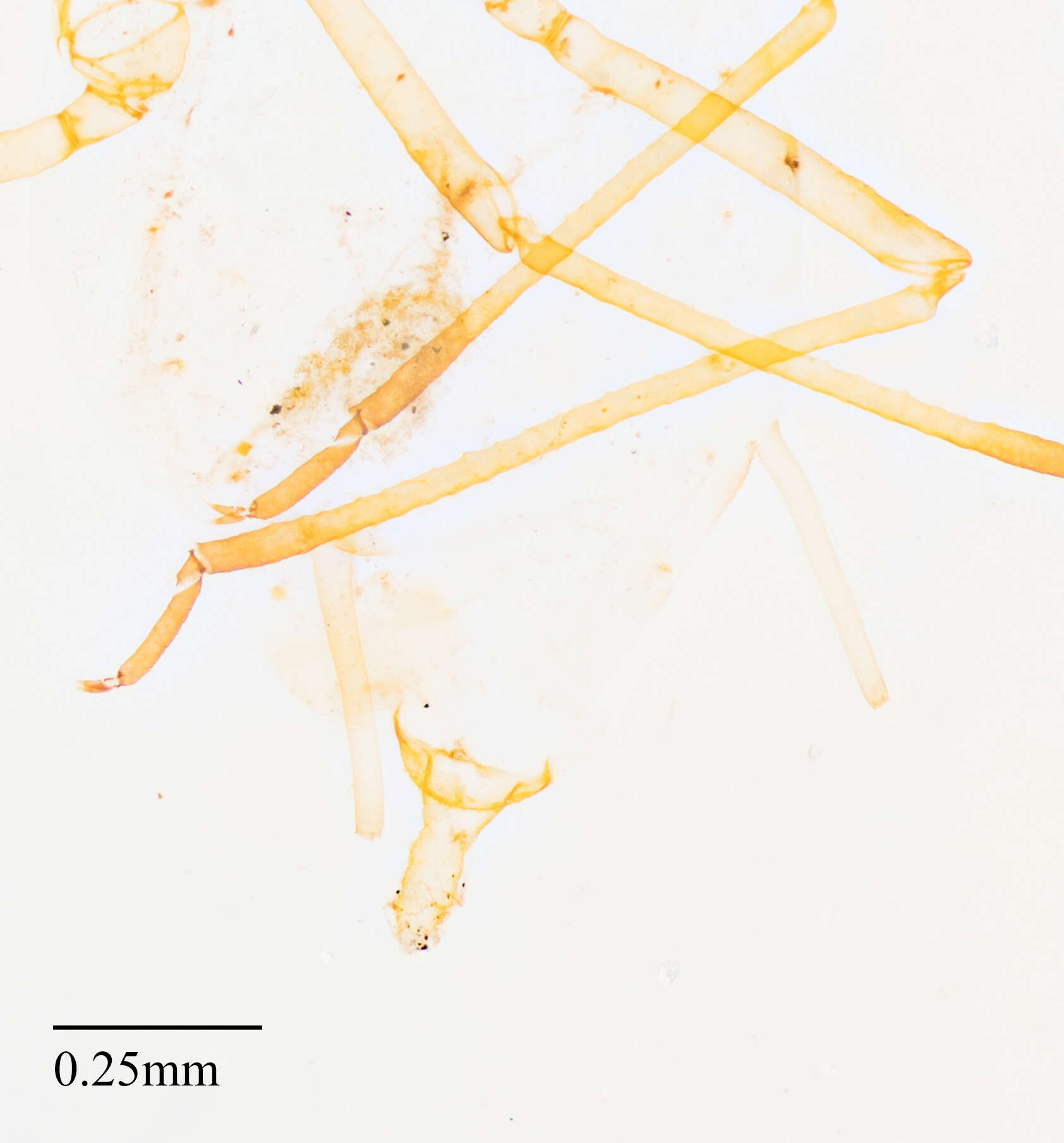 Plancia ëd Acyrthosiphon (Acyrthosiphon) lactucae (Passerini 1860)