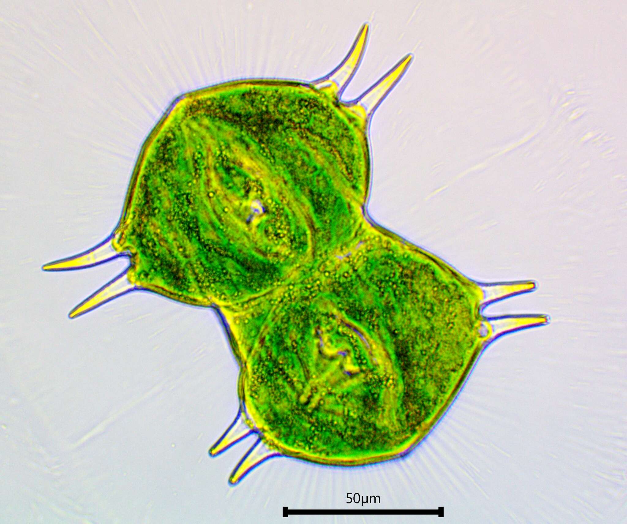 Image of Staurastrum longispinum (Bailey) W. Archer 1861