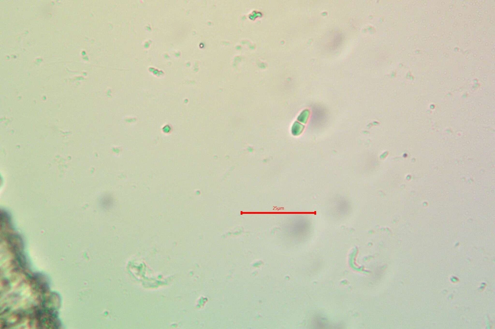 Imagem de Stigmidium squamariae (B. de Lesd.) Cl. Roux & Triebel 1994