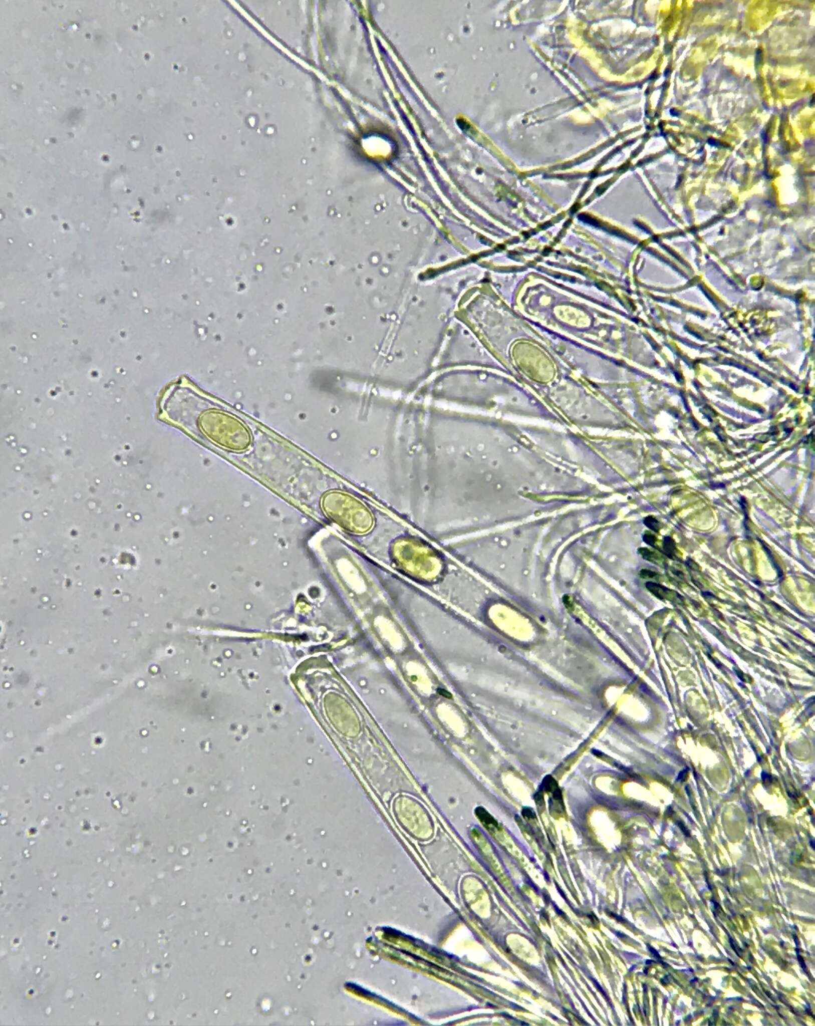 Pseudopithyella minuscula (Boud. & Torrend) Seaver 1928的圖片