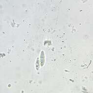 Image of <i>Bilimbia lobulata</i>