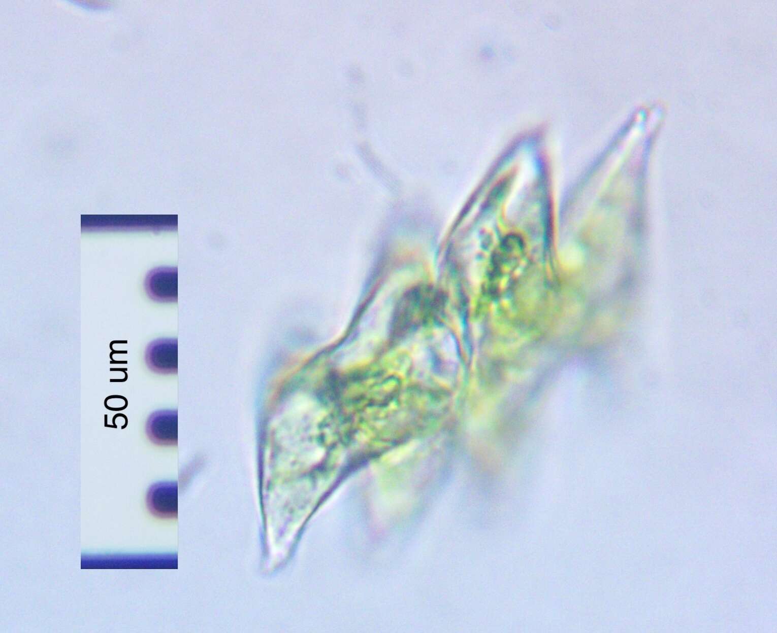 Image of Micrasterias pinnatifida