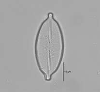 Image de Decussiphycus placenta (Ehrenberg) Guiry & Gandhi 2019