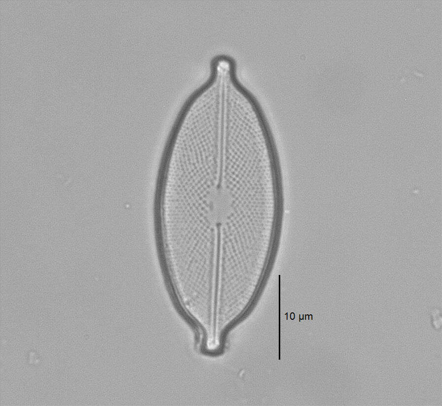 Image de Decussiphycus placenta (Ehrenberg) Guiry & Gandhi 2019