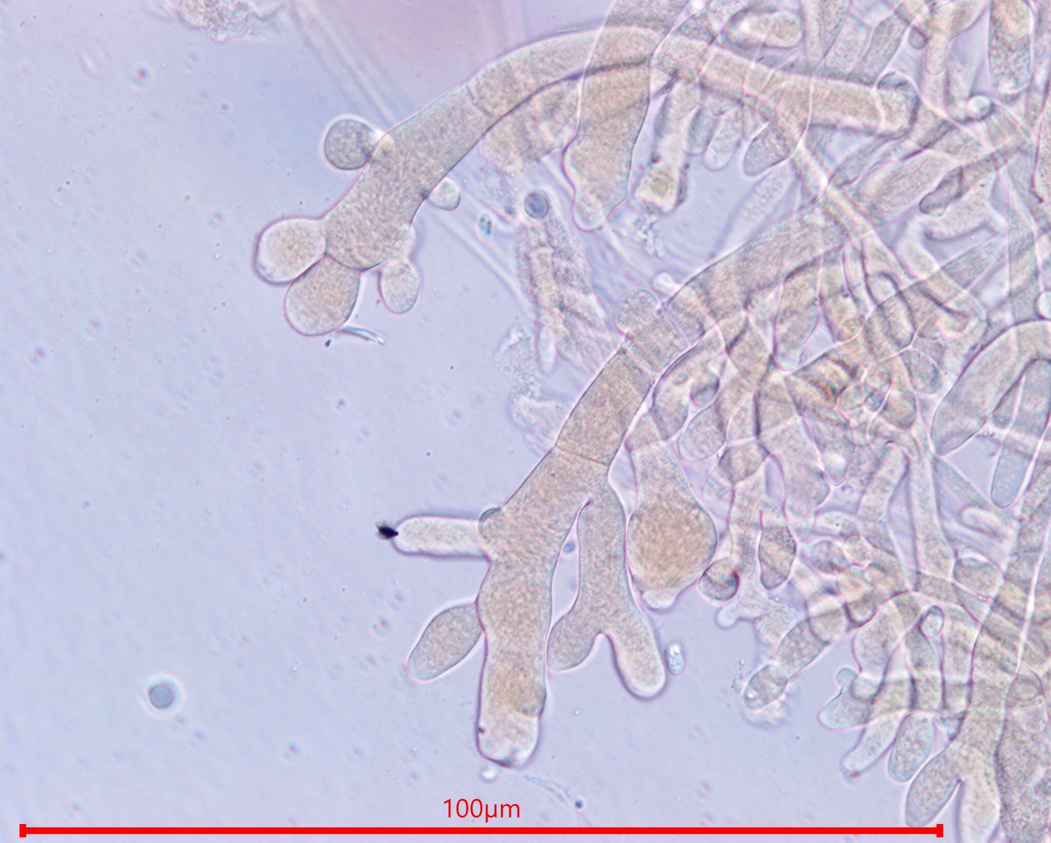 Plancia ëd Neurospora sitophila Shear & B. O. Dodge 1927