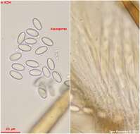 Image of Cheilymenia stercorea (Pers.) Boud. 1907