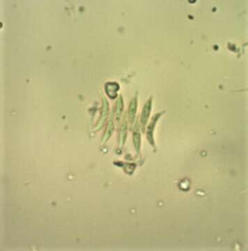 Image of Tetradesmus lagerheimii M. J. Wynne & Guiry 2016