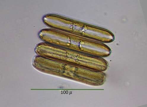 Pinnularia socialis (T. C. Palmer) Hustedt 1913的圖片