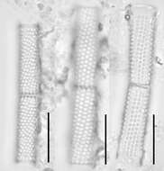Image of Aulacoseira granulata var. angustissima