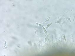 Image of strigula lichen