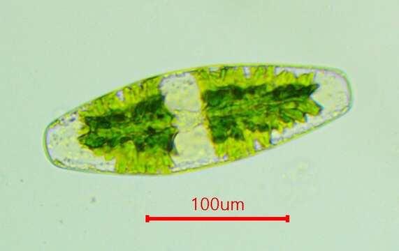 Image of Netrium (Naegeli) Itzigsohn & Rothe 1856