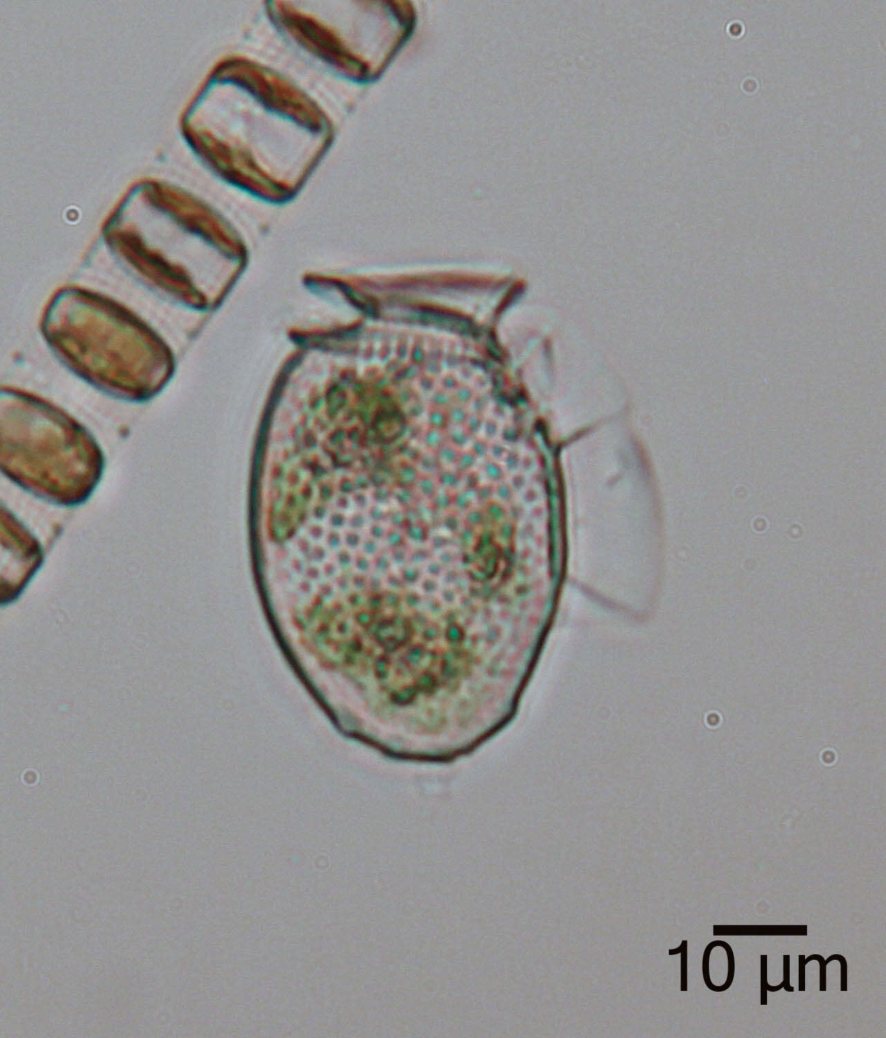 Dinophysis acuminata resmi