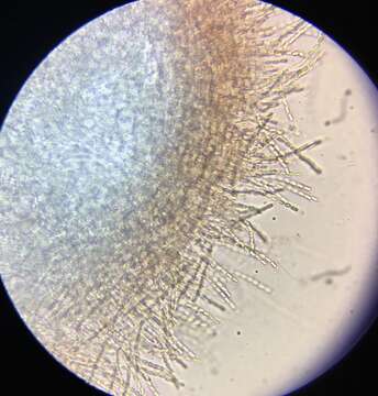 Image of Phomatospora coprophila M. J. Richardson 1972