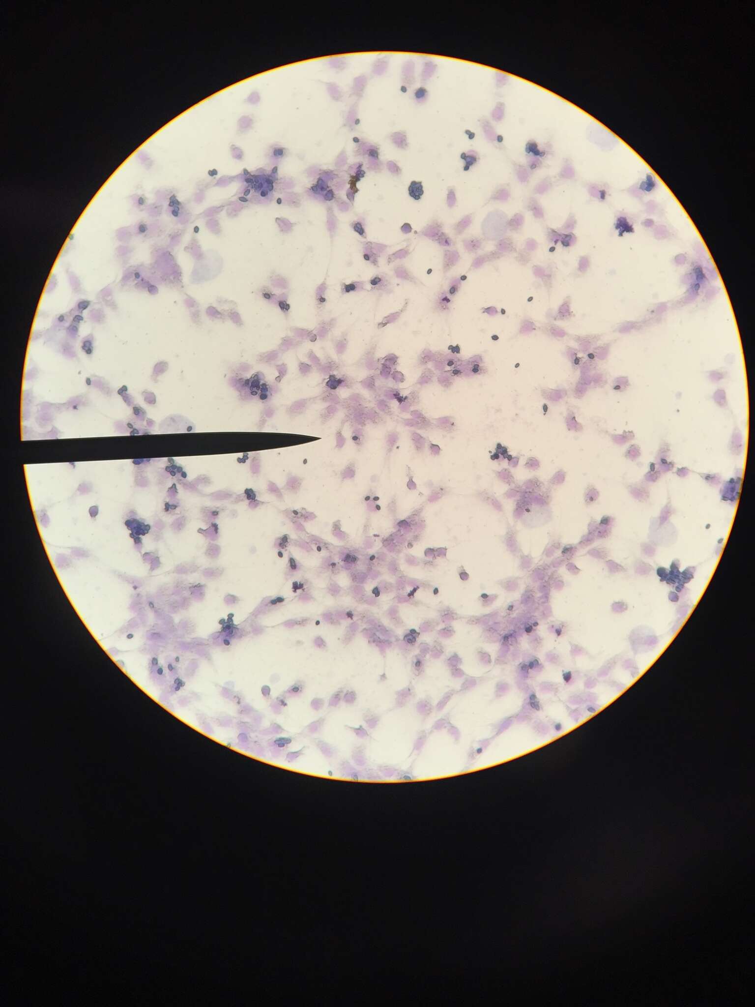 Image of Saccharomyces