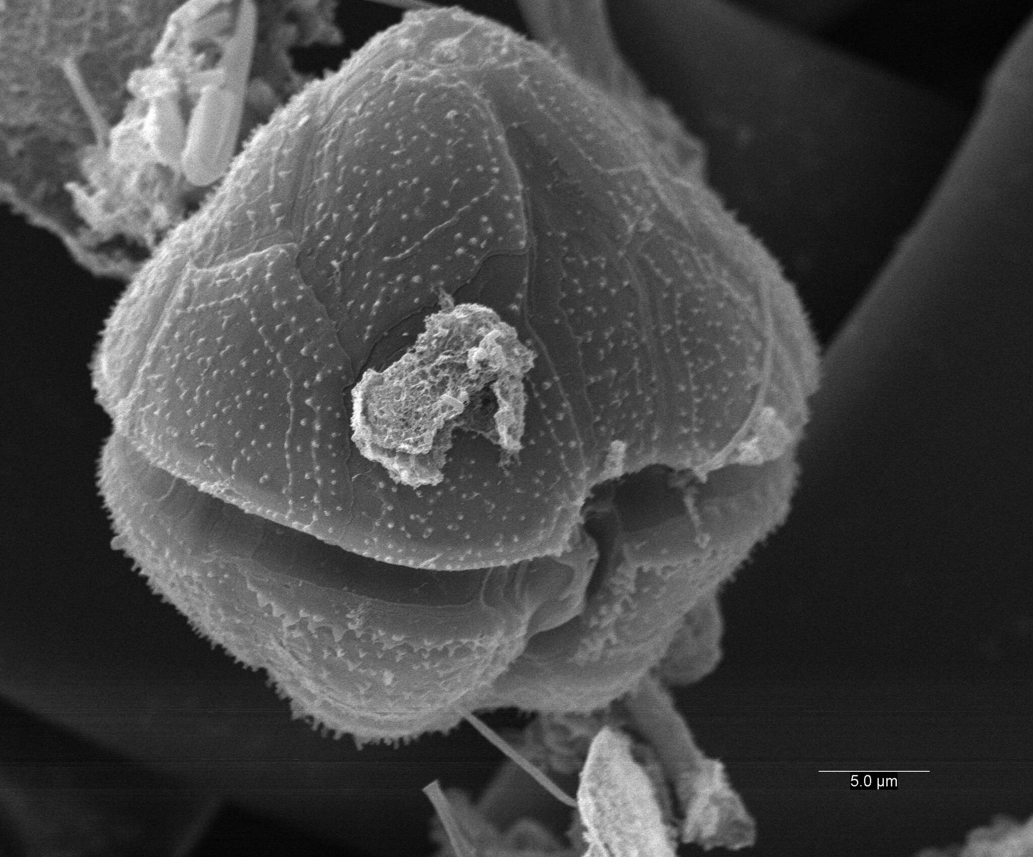 Image of Chimonodinium lomnickii