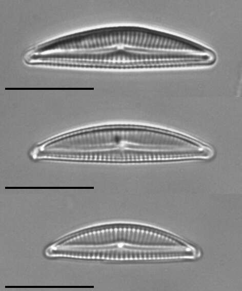 Image of <i>Encyonema evergladianum</i> Krammer 1997