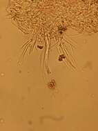 صورة Pezoloma ciliifera (P. Karst.) Korf 1971