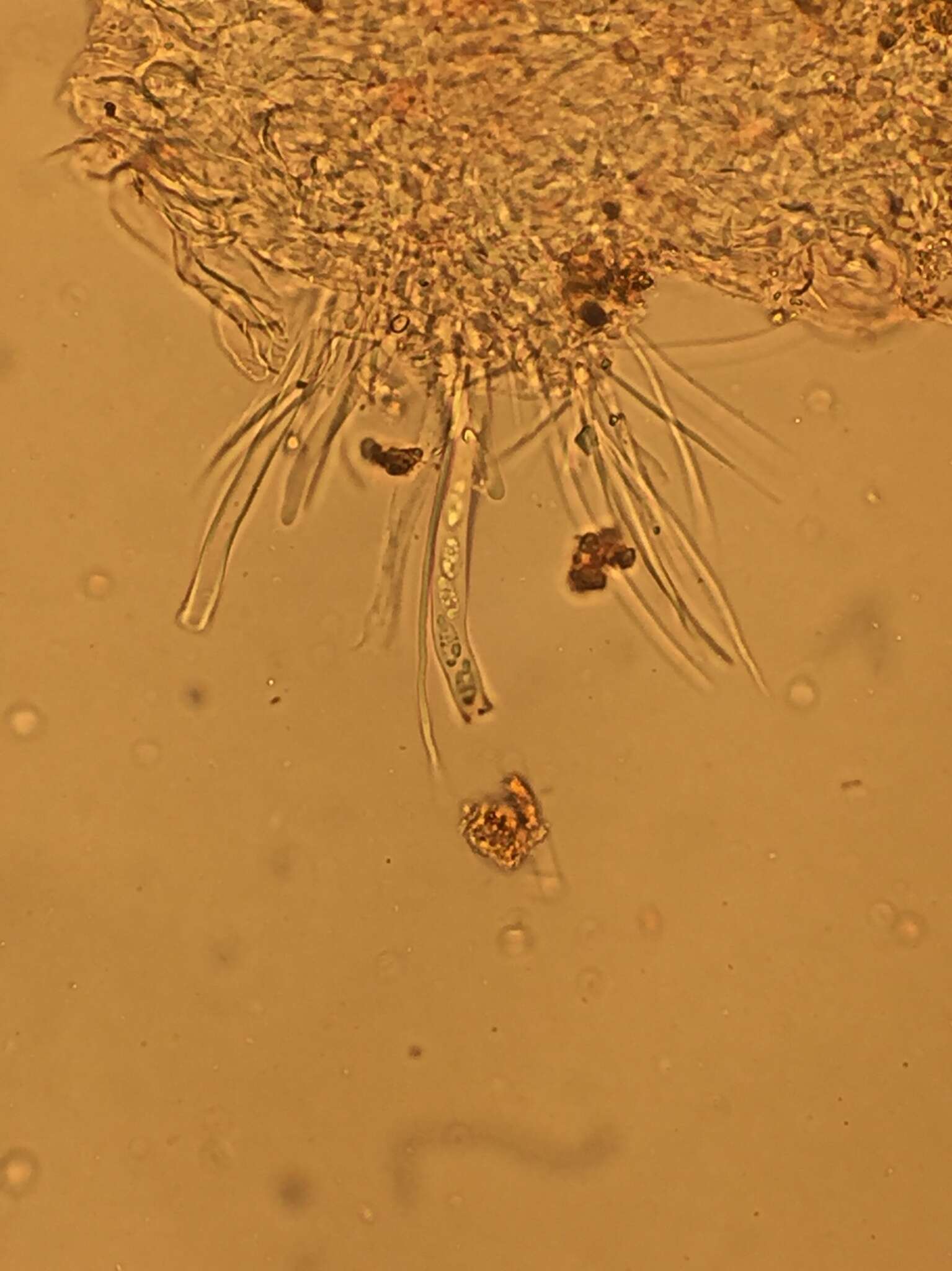 Imagem de Pezoloma ciliifera (P. Karst.) Korf 1971