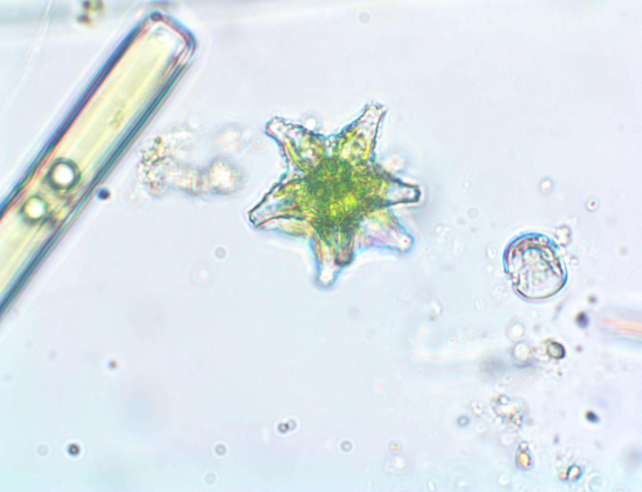 Image of Staurastrum margaritaceum