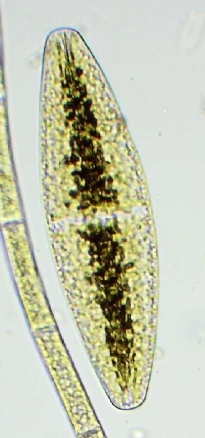 Netrium (Naegeli) Itzigsohn & Rothe 1856的圖片